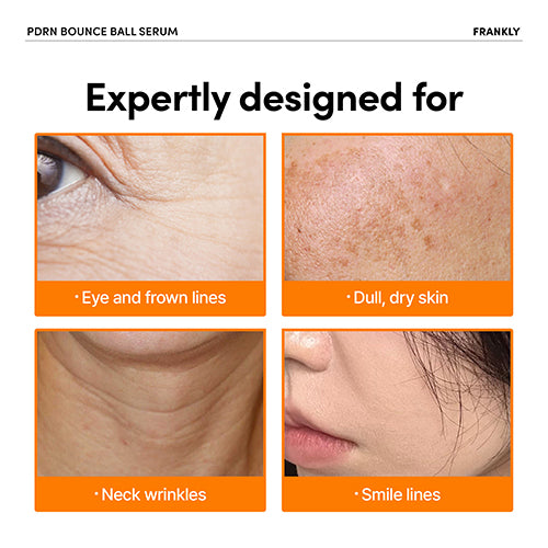 FRANKLY PDRN Bounce Ball Serum