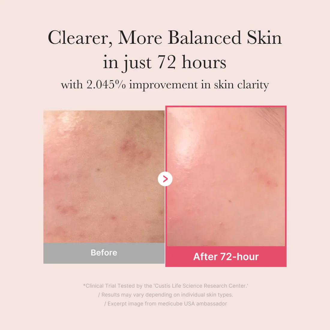 Medicube TXA Niacinamide Serum