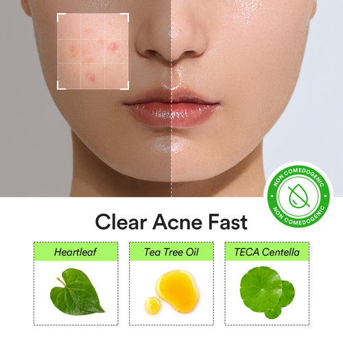 Abib Heartleaf calming spot patch
